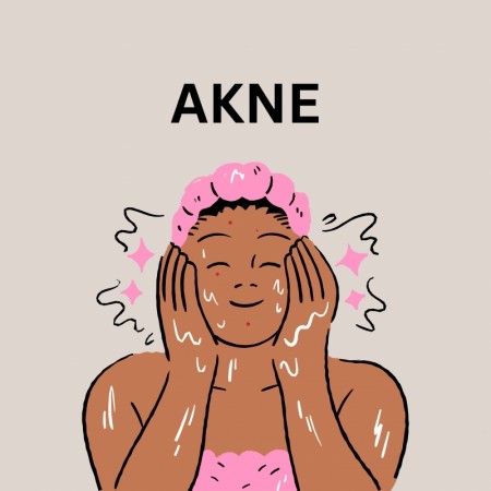 Akne